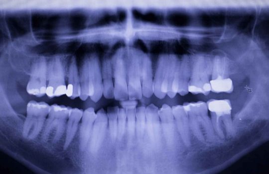 Mobile Dental CT Scans2